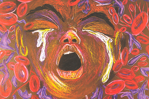 Ten Redefined by Hertz Nazaire - sickle cell disease art (detail)