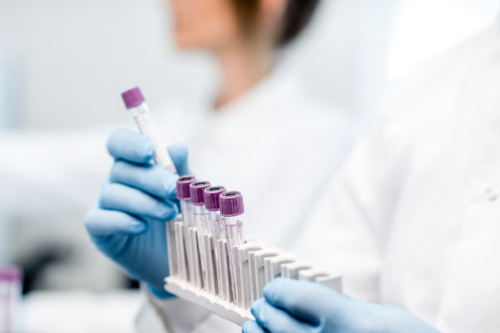 Test tubes in a rack held by gloved hands