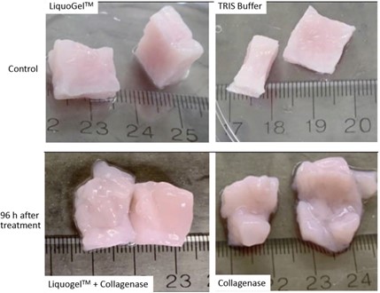 Fibroid tissue cubes were injected with collagenase 