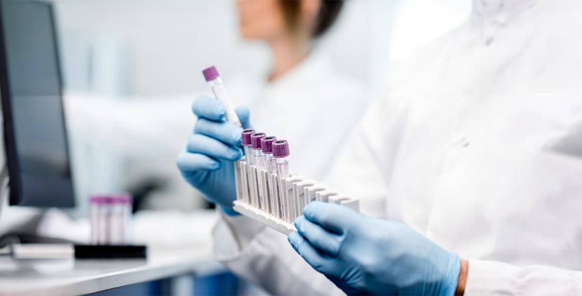 Blue gloved hands holding a test tube rack of blood samples. 