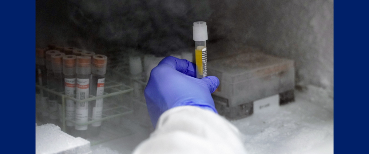 Photo of researcher's hand holding sample in freezer