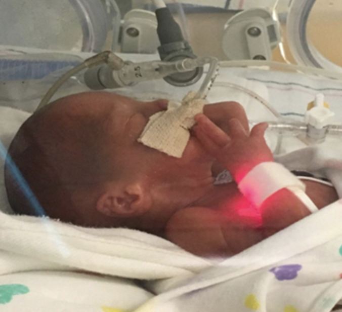 An infant at Duke's Neonatal-Perinatal Research Unit