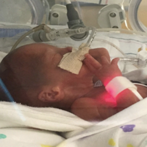 An infant at Duke's Neonatal-Perinatal Research Unit