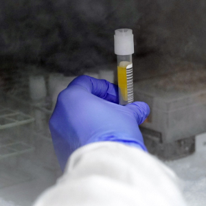 Photo of clinician's hand retrieving a sample from a freezer